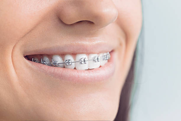 Dental X-Rays and Imaging in Lakewood Park, FL